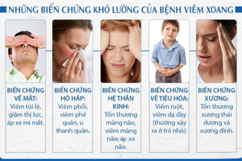 Tìm hiểu về viêm xoang và những biến chứng có thể gặp